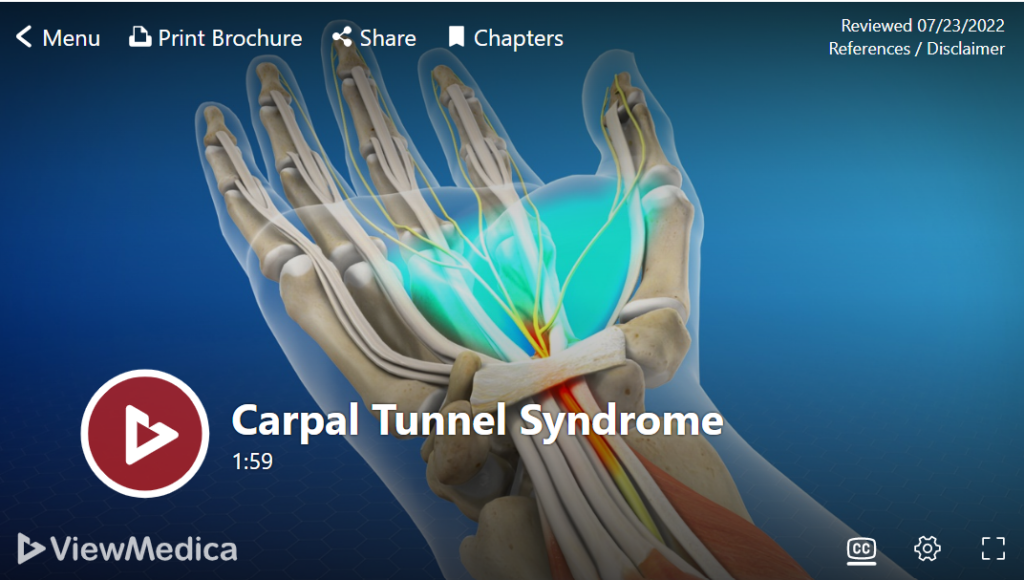 carpal tunnel syndrome video